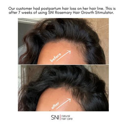 SNI Rosemary Hair Growth Stimulator