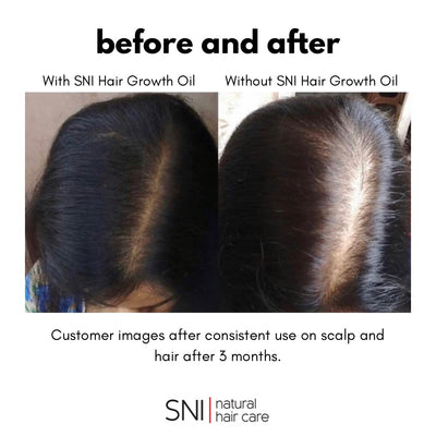 SNI Natural Hair Growth Oil